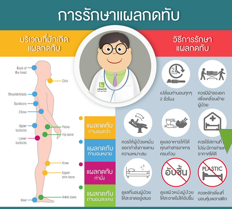 การรักษาแผลกดทับ